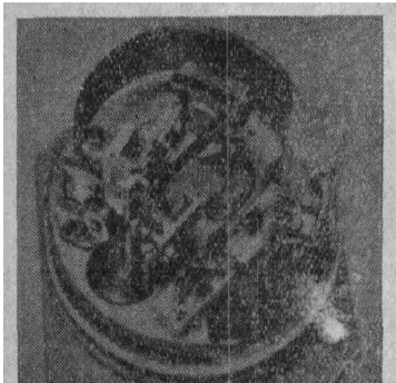 ΢�ͽM��ʽ����׃�����ĽY(ji��)��(g��u)�D